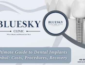 The Ultimate Guide to Dental Implants in Istanbul: Costs, Procedures, Recovery