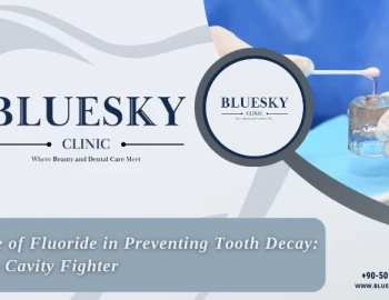 The Role of Fluoride in Preventing Tooth Decay: Nature's Cavity Fighter