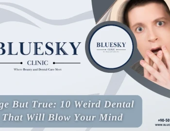 Strange But True: 10 Weird Dental Facts That Will Blow Your Mind