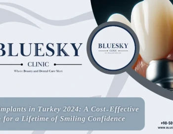 Dental Implants in Turkey 2024: A Cost-Effective Solution for a Lifetime of Smiling Confidence