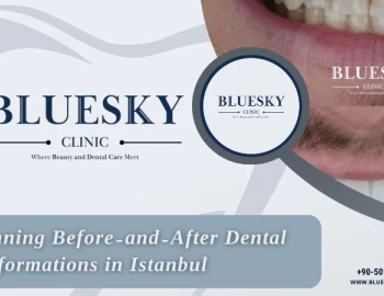 7 Stunning Before-and-After Dental Transformations in Istanbul