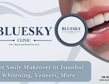 Instant Smile Makeover in Istanbul: Teeth Whitening, Veneers, More