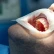 علاج لبّ الأسنان في تركيا